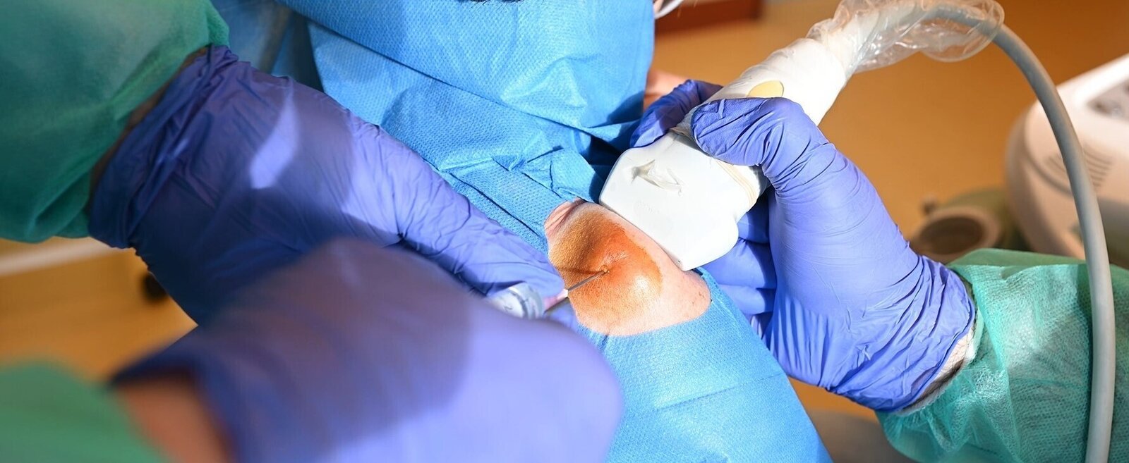 NAKŁUCIE KALETKI STAWU BARKOWEGO POD KONTROLĄ USG